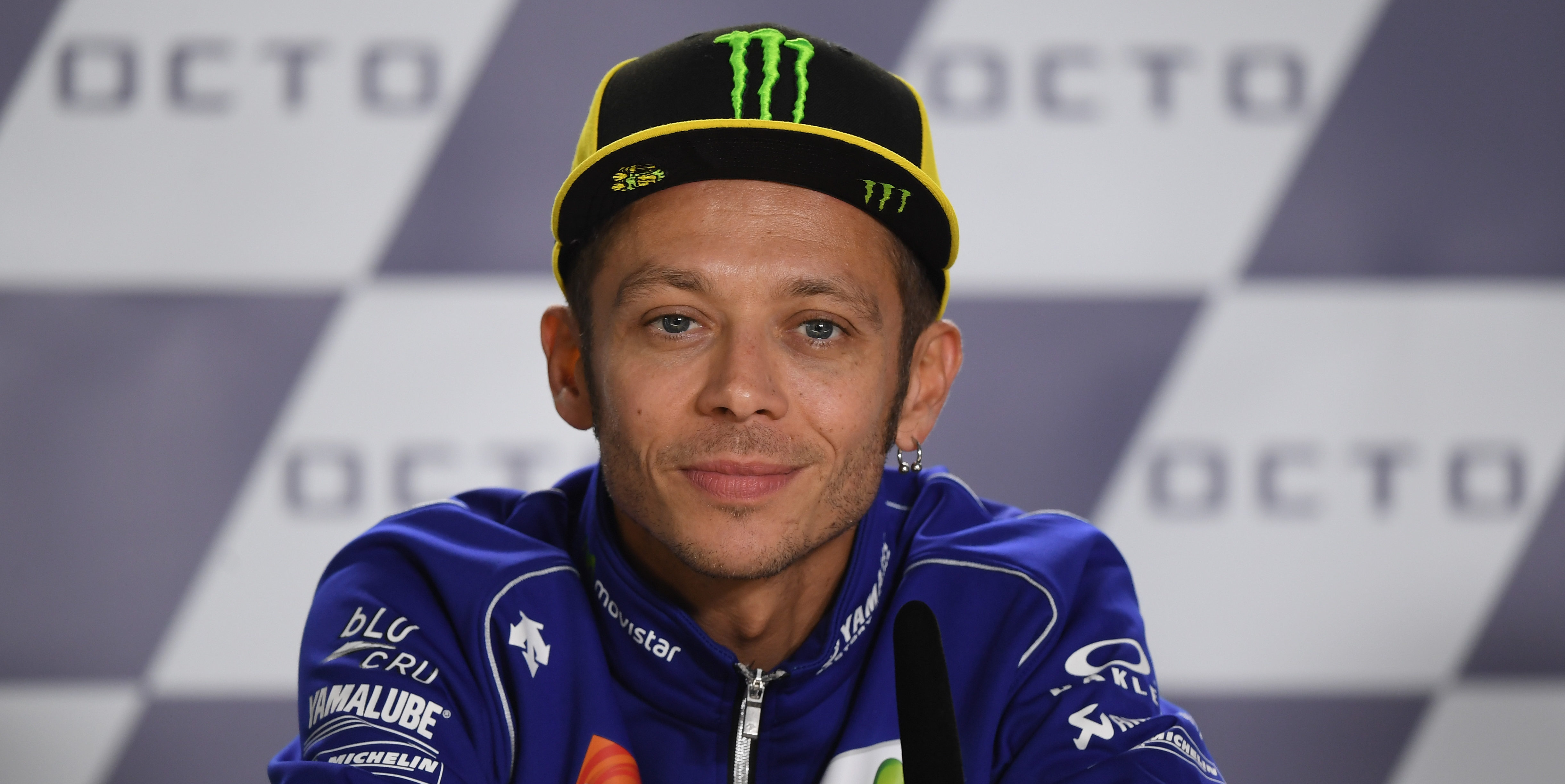 Rossi undergoes successful surgery on leg fracture